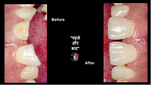 Case Done By Dr Y K Virmani more than 15 years back